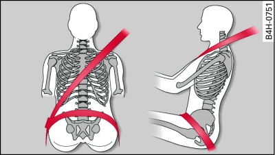 Colocación de la banda del hombro y de la banda abdominal